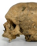 Neanderthaloid Skull